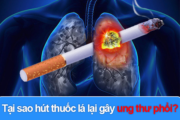 Tại sao hút thuốc lá lại gây ung thư phổi?